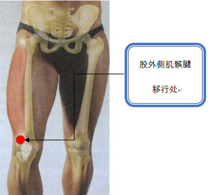 股外侧肌髌腱移行处痛点.png