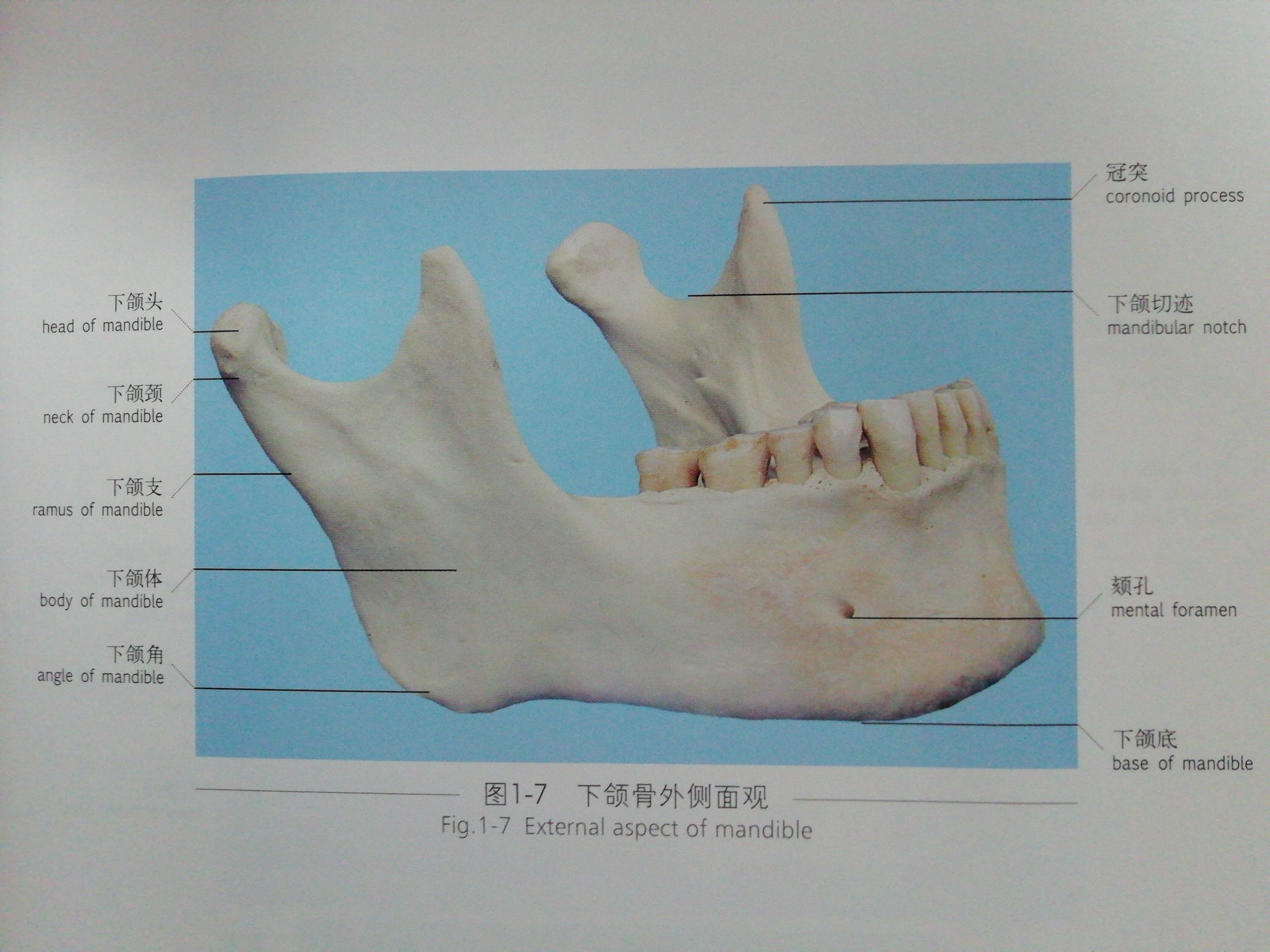 下颌骨骨折好发部位 