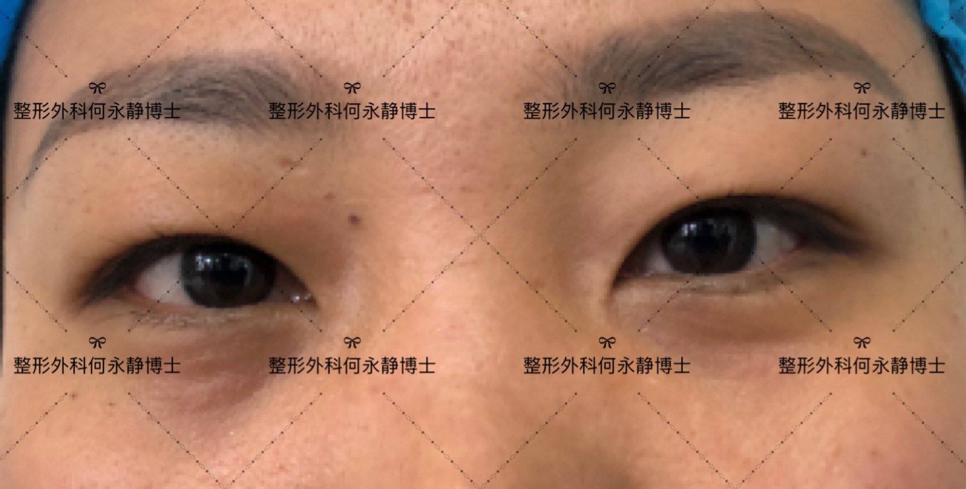 暂无