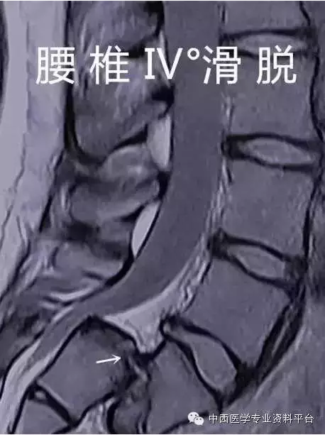 暂无
