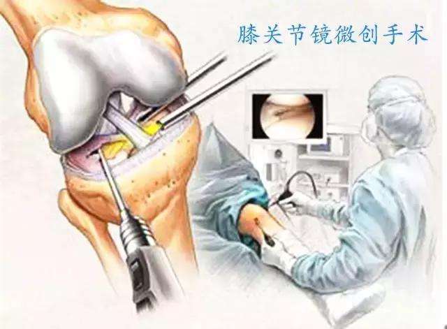 什么是关节囊 woYBAF1PyvGALlZbAAB4o8E9rfs580.jpg?_ms_=45e3