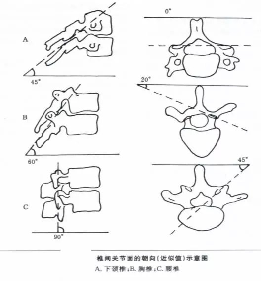 聊聊啥是腰椎间盘突出症?