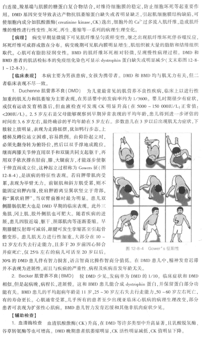 单基因病-x连锁隐性遗传病进行性肌营养不良dmd/bmd - 好大夫在线