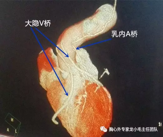 暂无