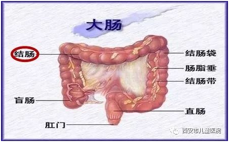 巨结肠分型图片