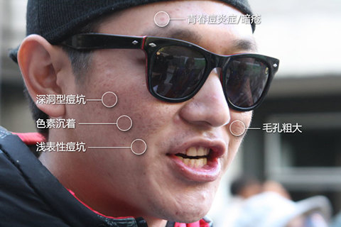 暂无