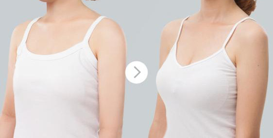 八大处整形赵延勇:北京隆胸假体需要定期更换吗