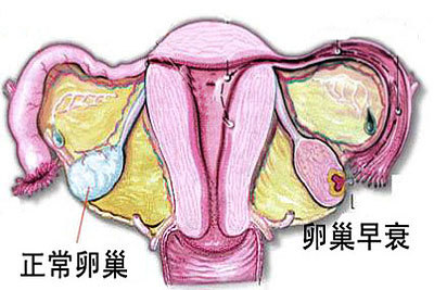 两侧卵巢图片图片