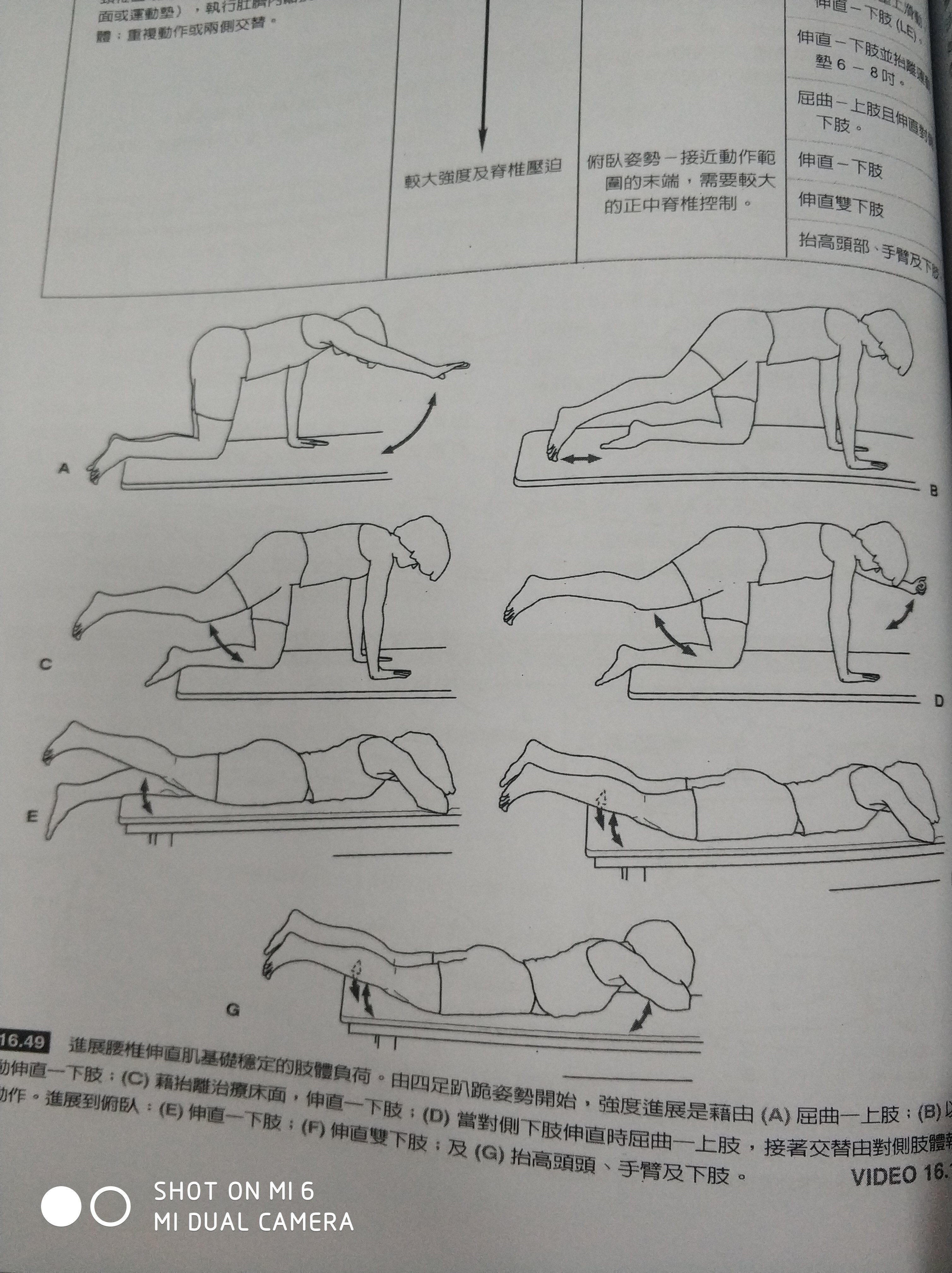 脊柱侧弯20锻炼方法图图片