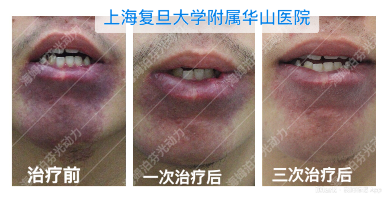 暂无