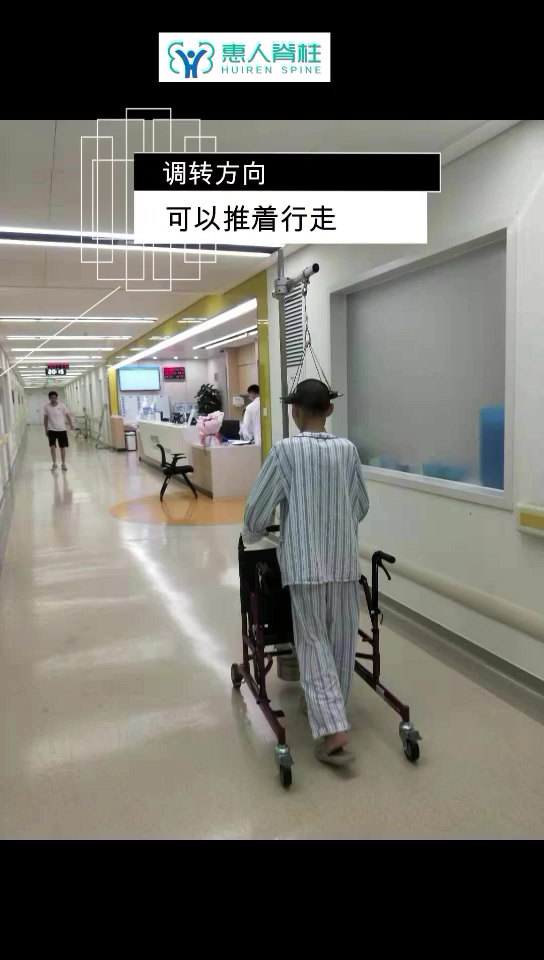 重度脊柱侧弯术前halo 头环牵引 陶惠人教授 - 好大夫在线