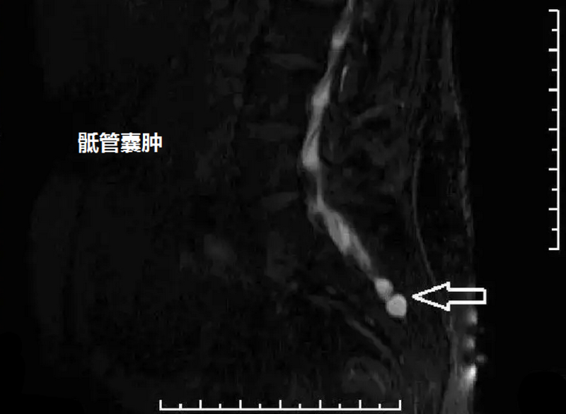 圖文圖片