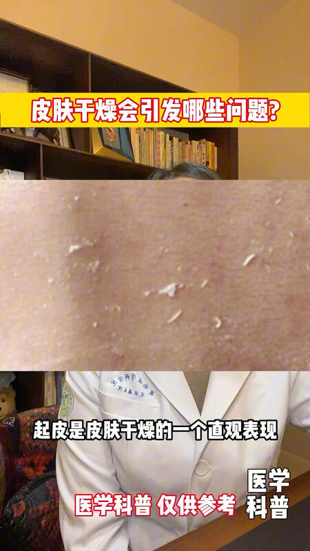 視頻封面