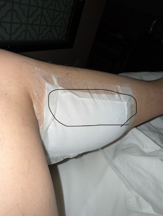 小腿肌肉酸痛是怎么了 wYYBAGgWzWGATg2yAADSCe9BocQ946.jpg?_ms_=155c