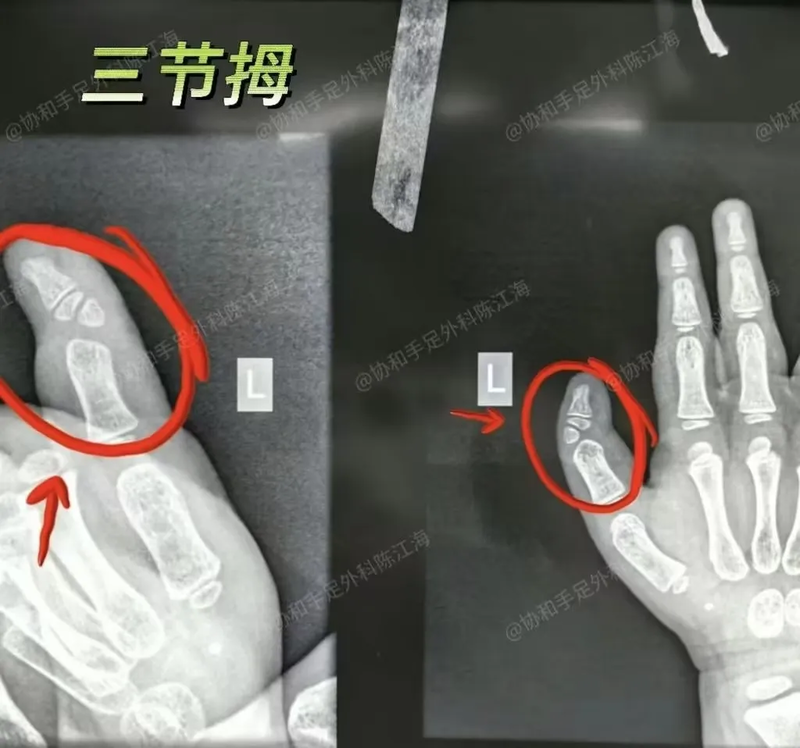 圖文圖片