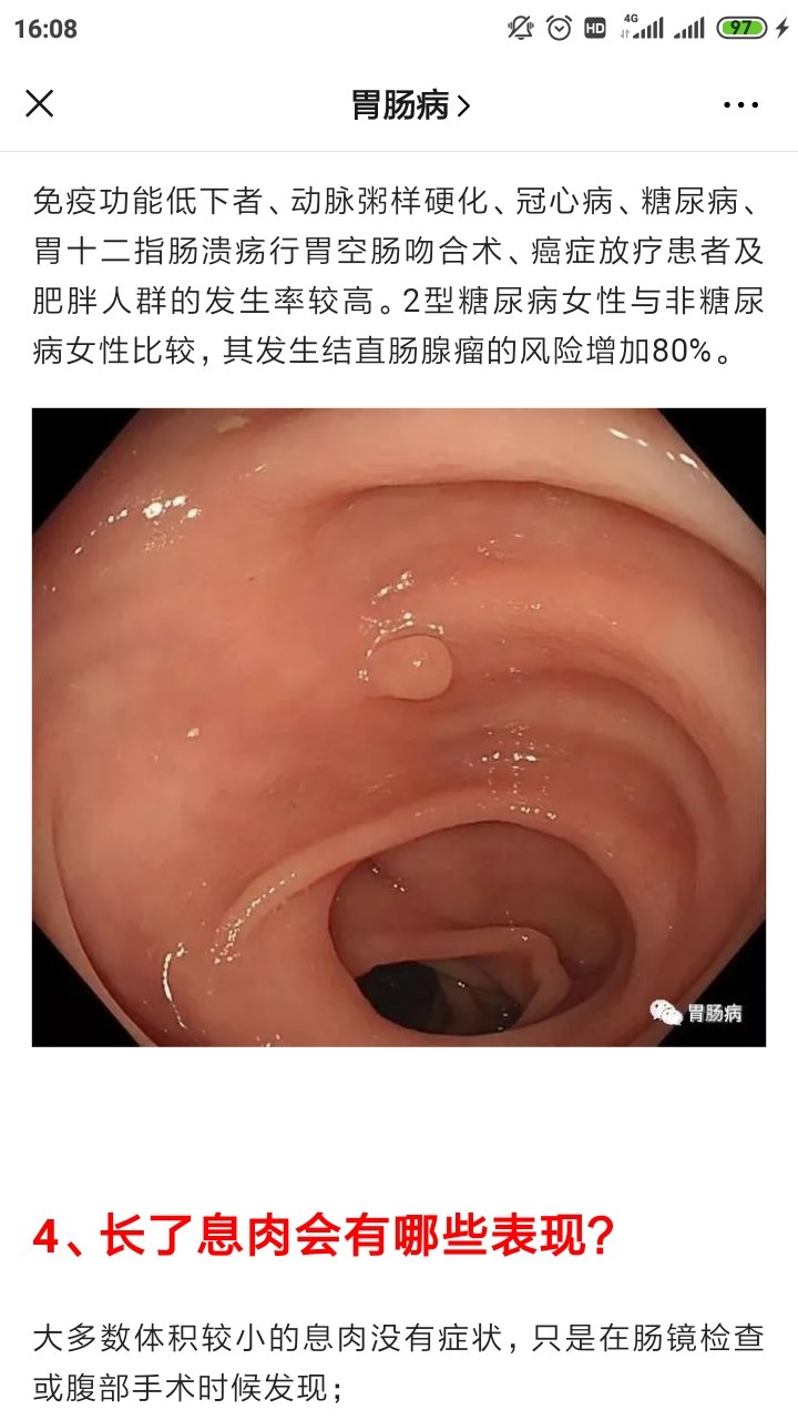 帶您認識腸息肉一息肉的定義性質為什麼會長息肉