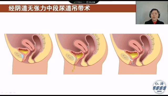 默认图片