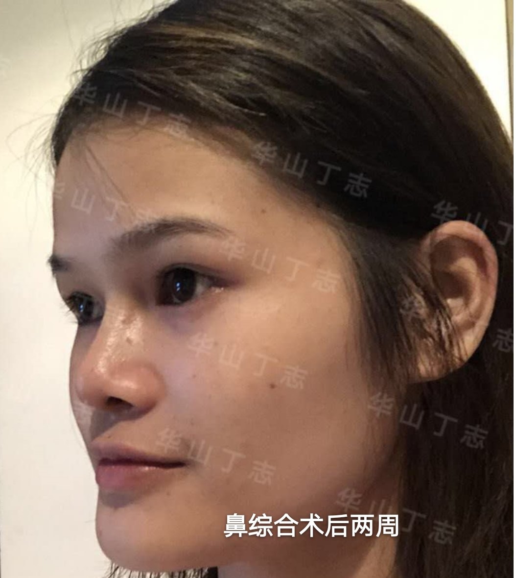 暂无