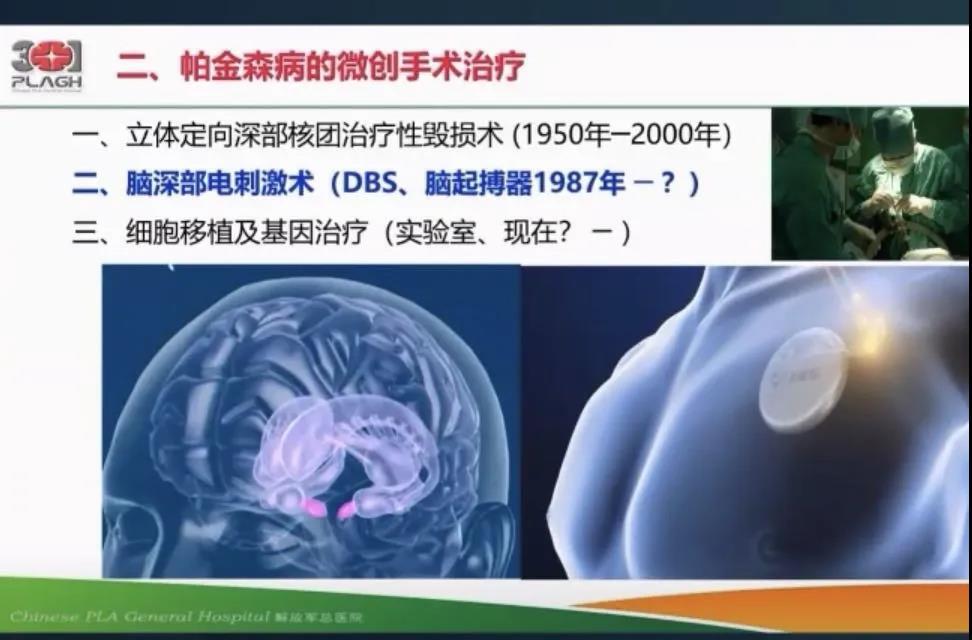微创手术.jpg