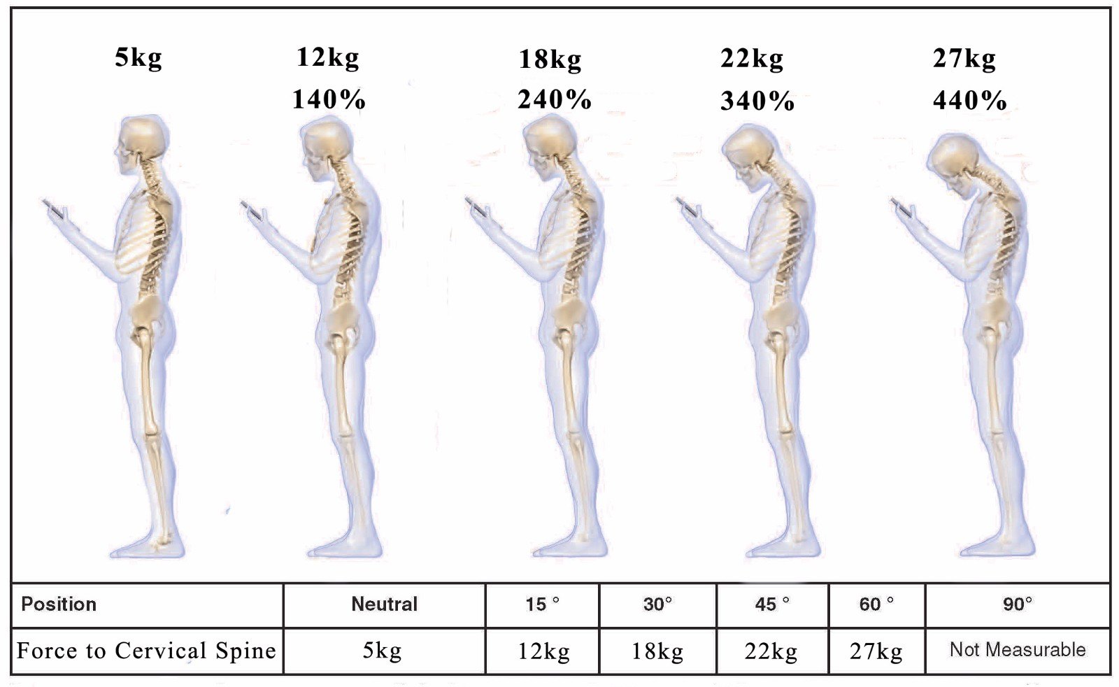 可以看到随着颈椎前屈角度增大,压力逐步增大,这就不难理解当今颈肩部