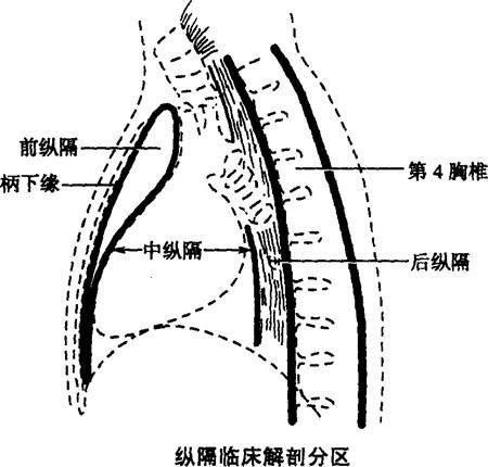 劉懿博士說肺癌三四六發現前縱隔結節手術還是觀察