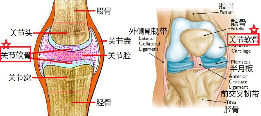 膝关节软骨损伤怎么办 好大夫在线