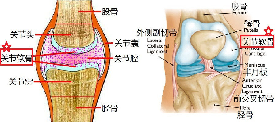 膝关节软骨损伤怎么办 膝关节软骨损伤怎么办