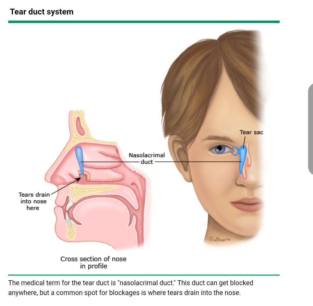 泪管阻塞是怎么回事