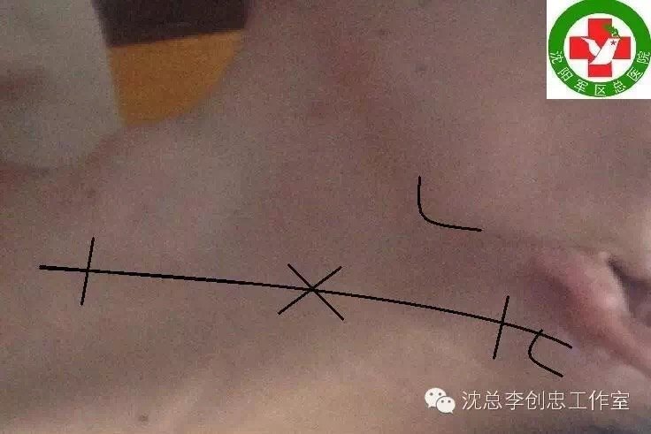 暂无