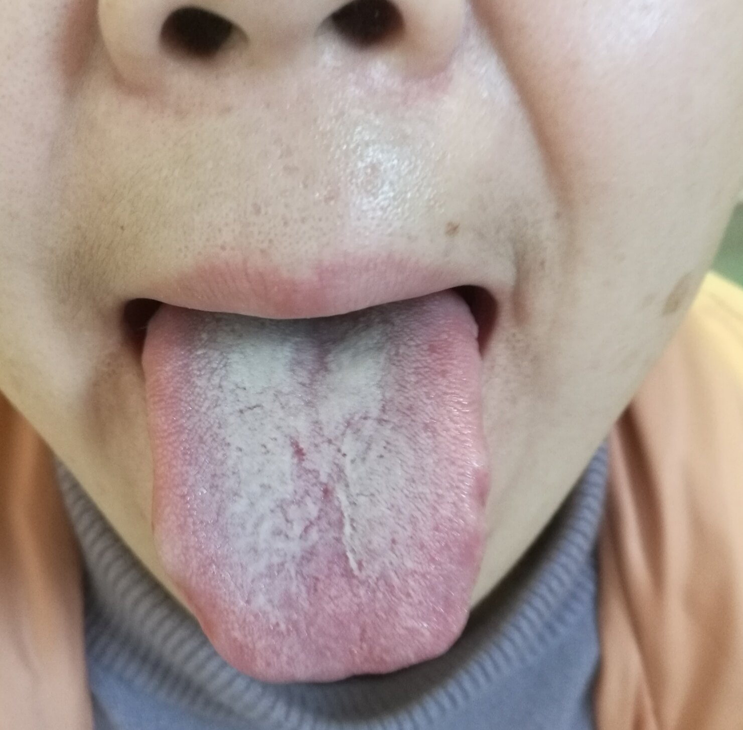 暂无
