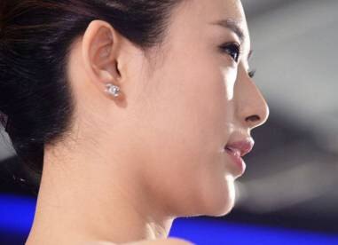 所谓的福相双下巴,你真的愿意拥有吗?