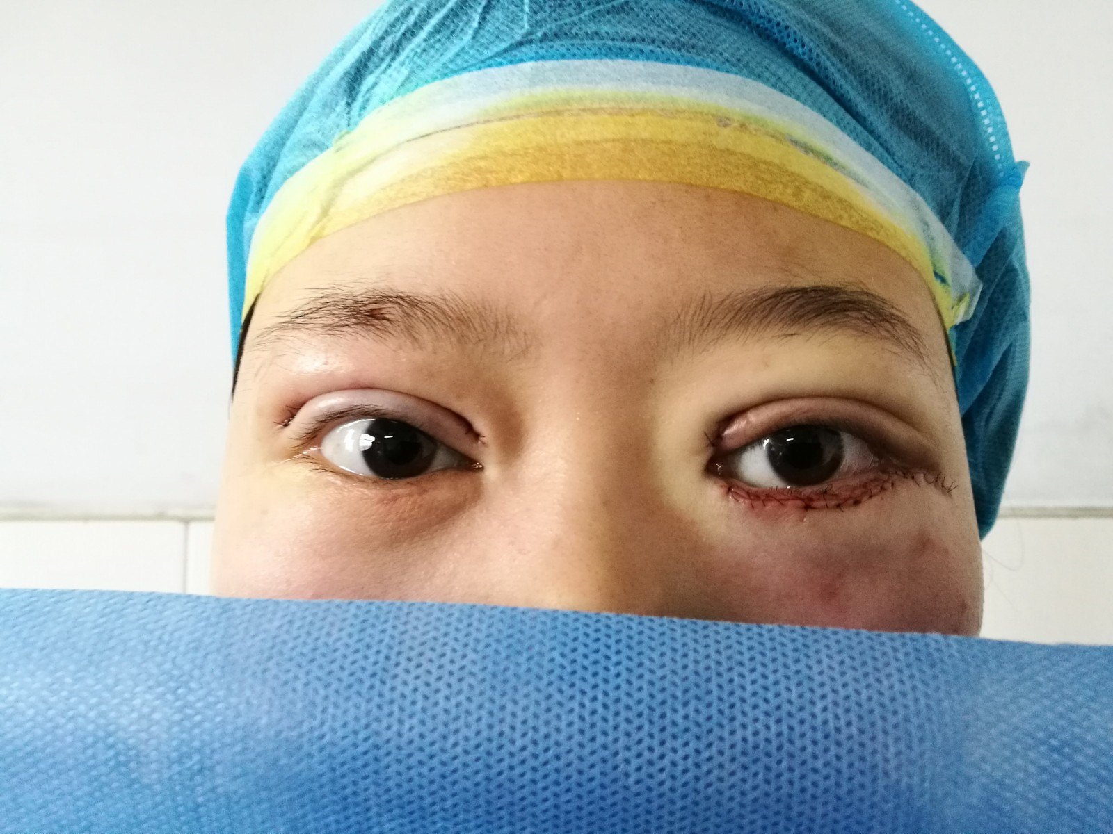 西苑医院代挂专家号加代问诊各类报告结果跟踪,及时掌握病情的简单介绍 西苑医院代挂专家号加代问诊各类报告结果跟踪,及时掌握病情的简单介绍
