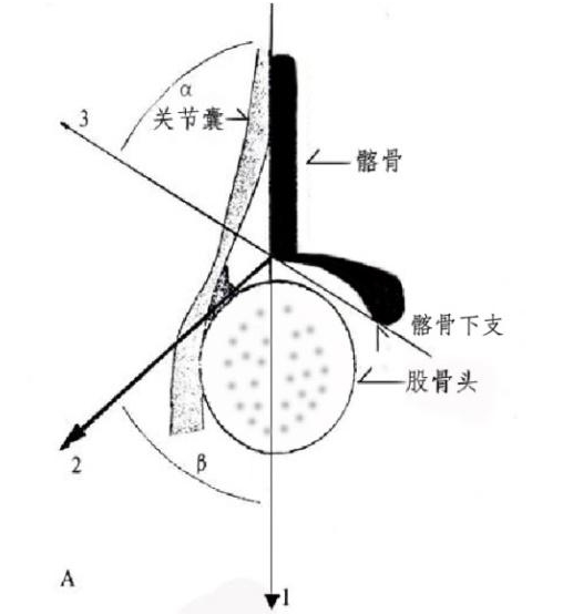 图3  α角和β角的测量图2  标准冠状切面