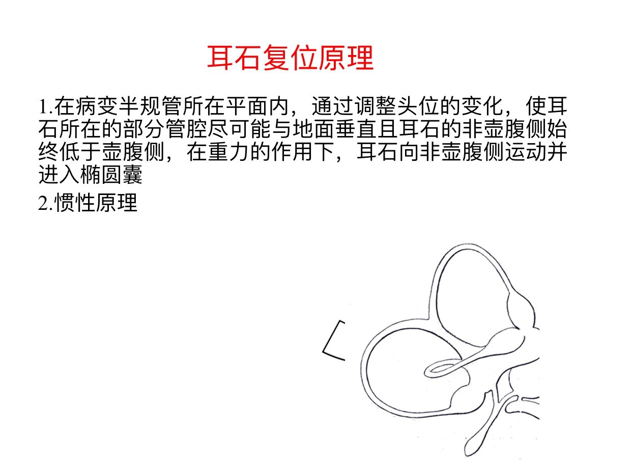 16张图片教您认识一种眩晕病耳石症