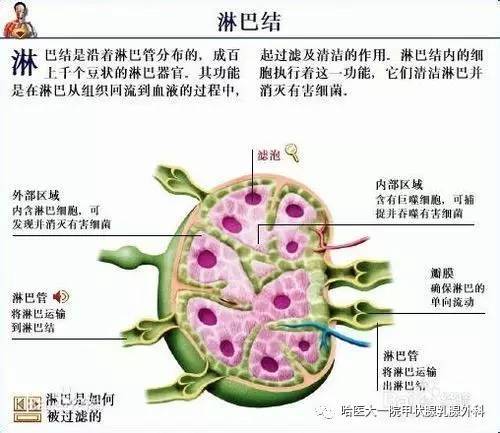 淋巴结是什么引起的图片