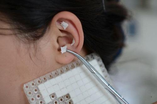 杨周剑 文章列表 耳穴埋豆:中医认为人的五脏六腑均可以在耳朵上找到