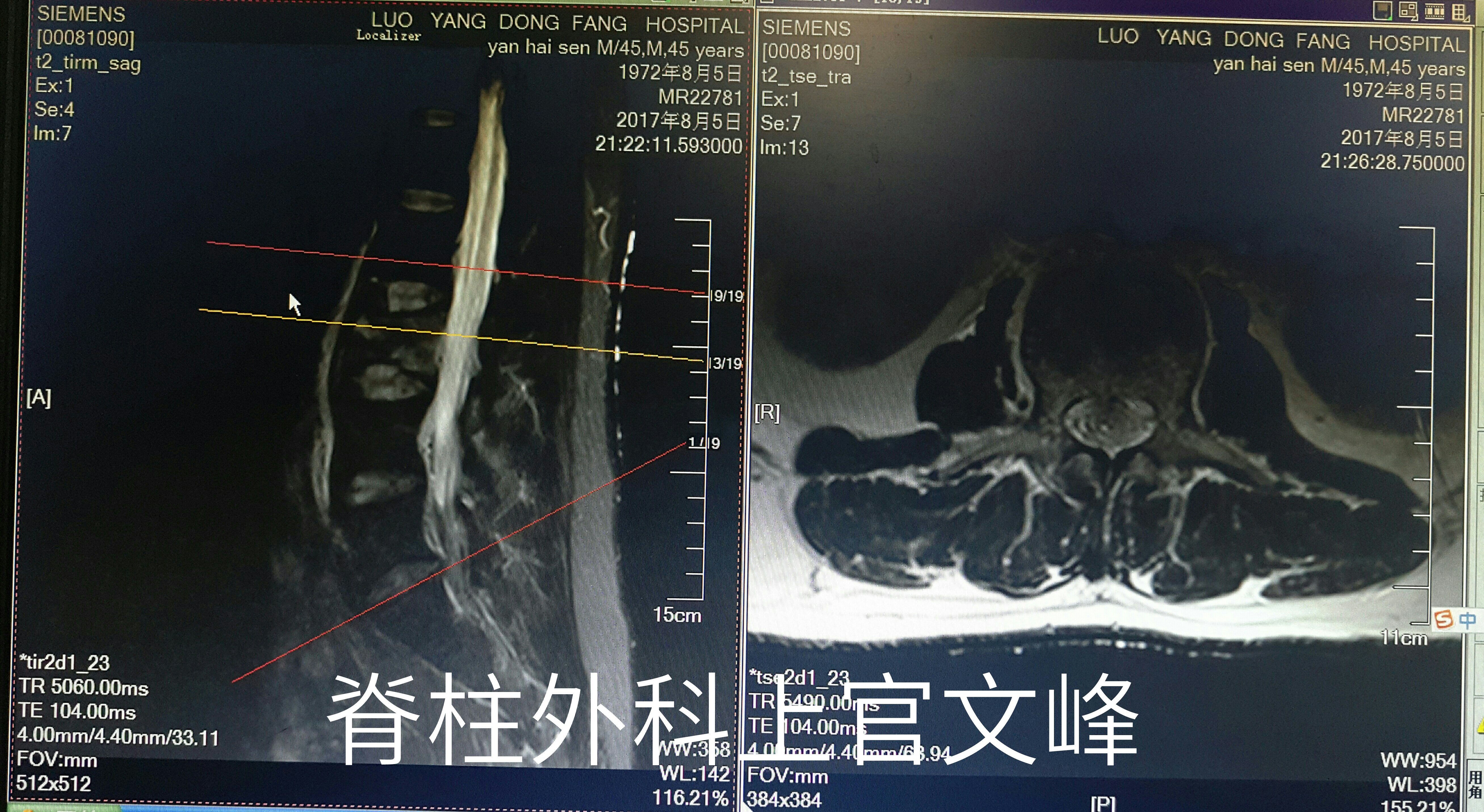 暂无