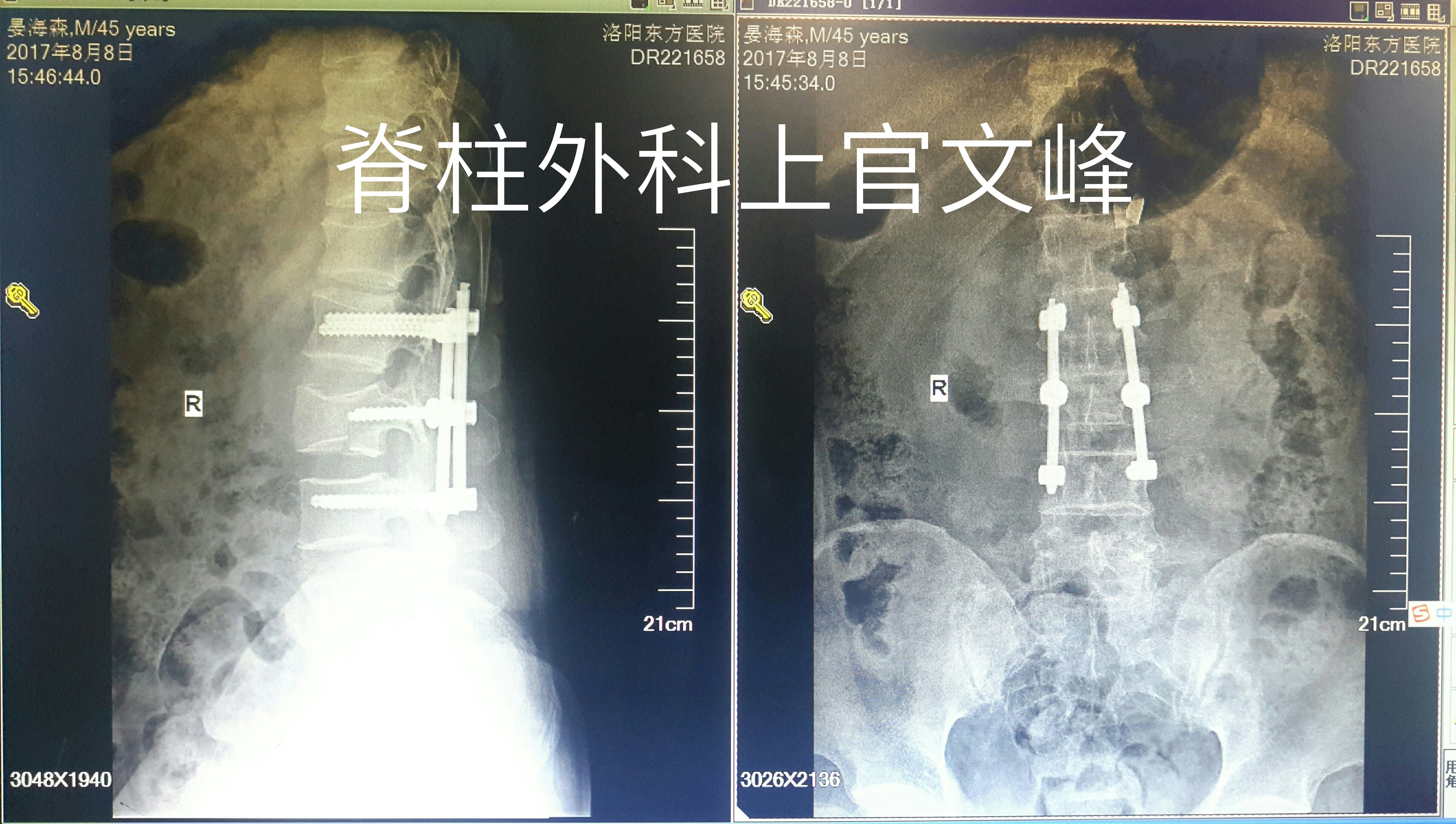 暂无
