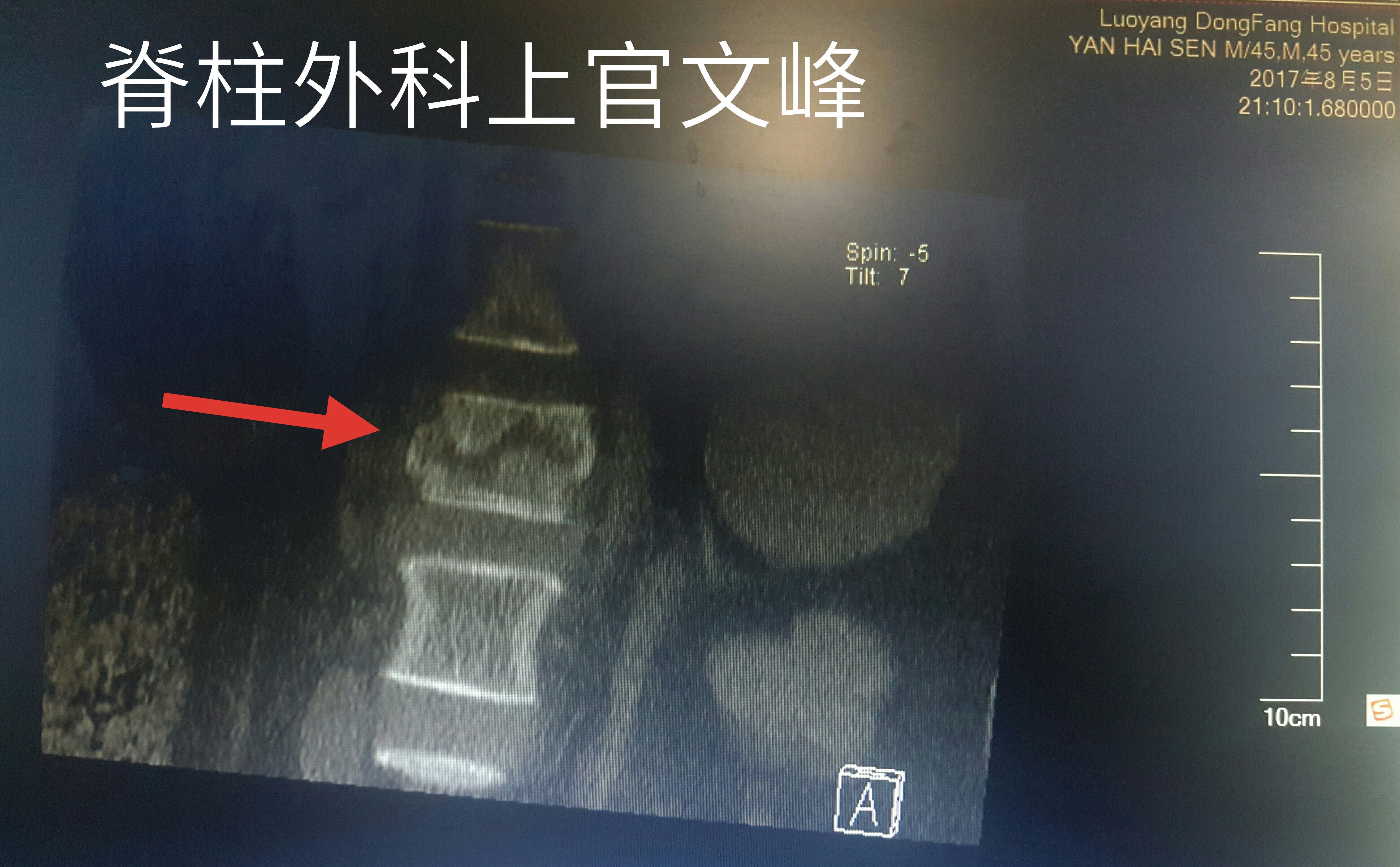 暂无