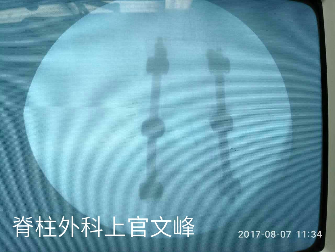 暂无