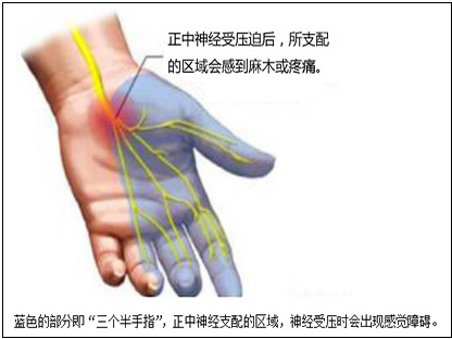 碗管是一条腕骨构成底和两侧壁,腕横韧带覆盖其上组成的骨