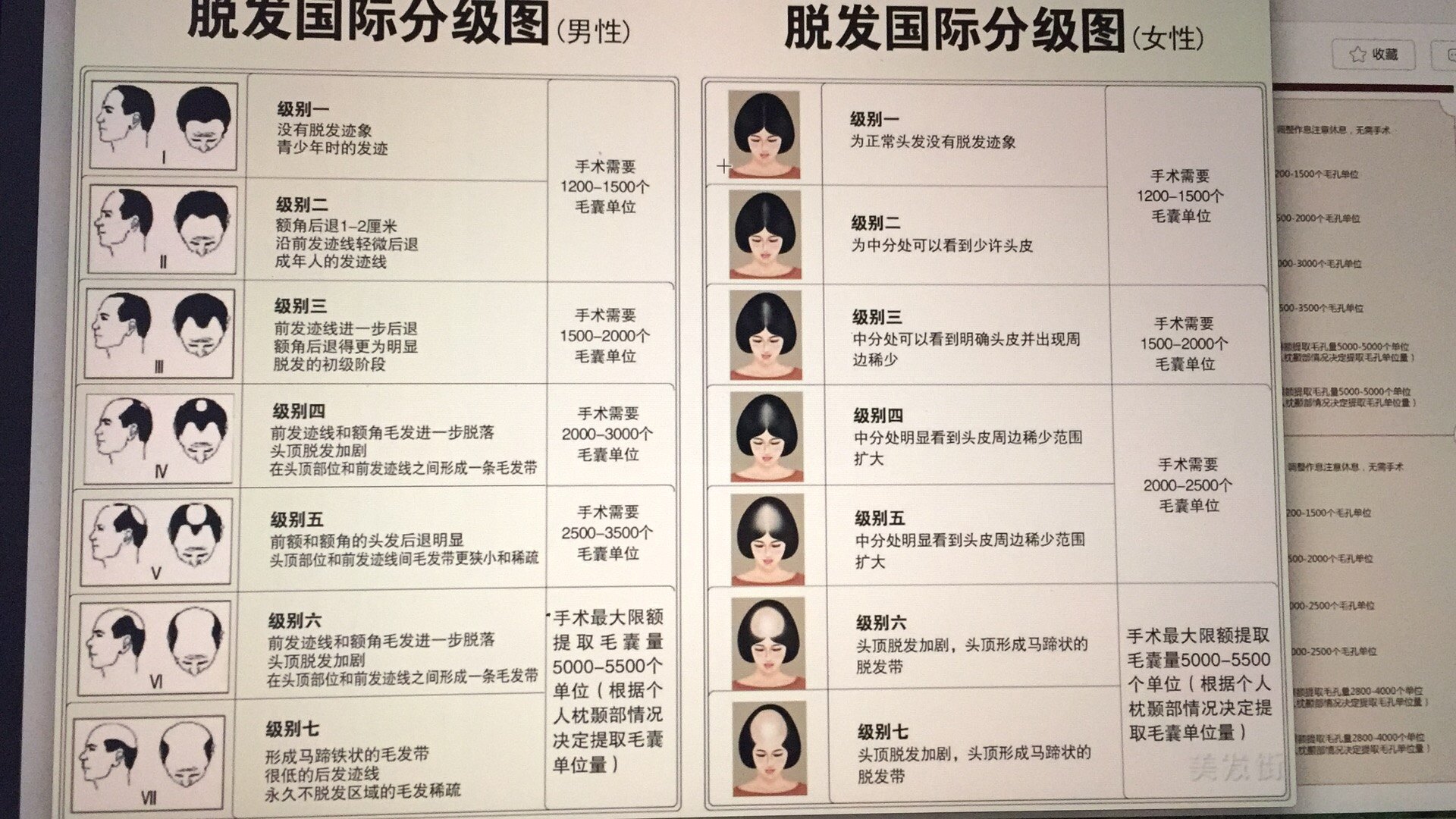 一张图介绍雄脱的分级