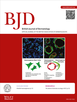 感兴趣的可以搜索(the british journal of dermatology.