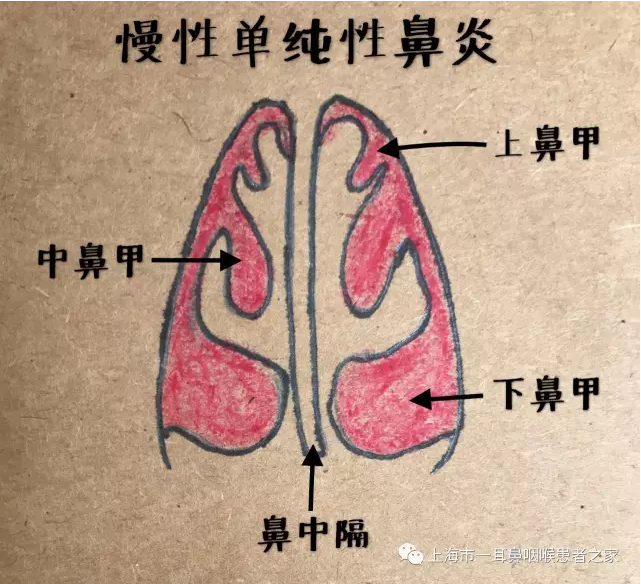 暂无