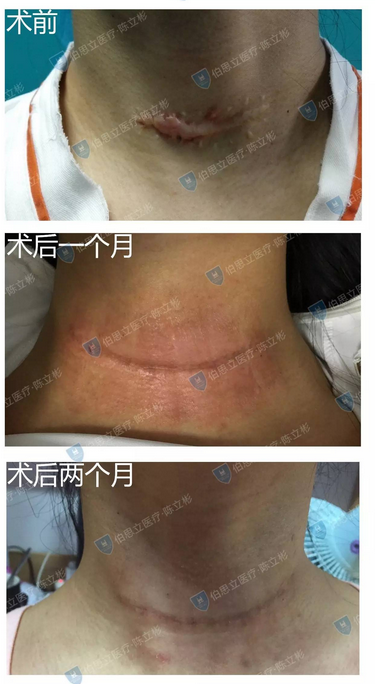 图说"减张精细缝合"