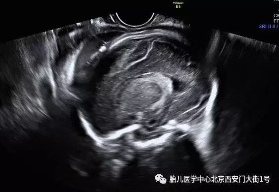 暂无
