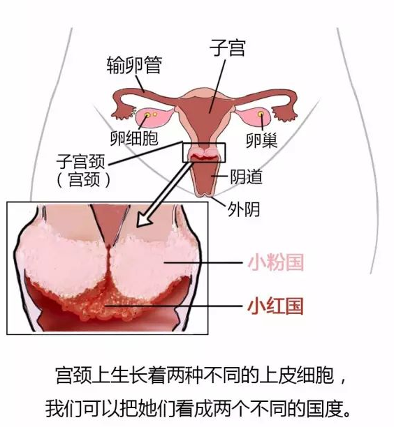 宫颈纳囊图片 慢性图片