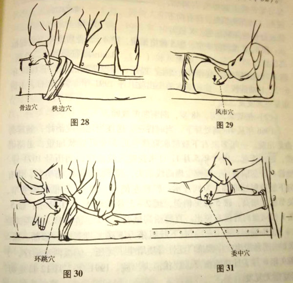 中医正骨手法治疗腰椎间盘突出