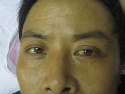 《难经》曰:"望而知之谓之神",很多的身体症状是可以通过面部器官表现