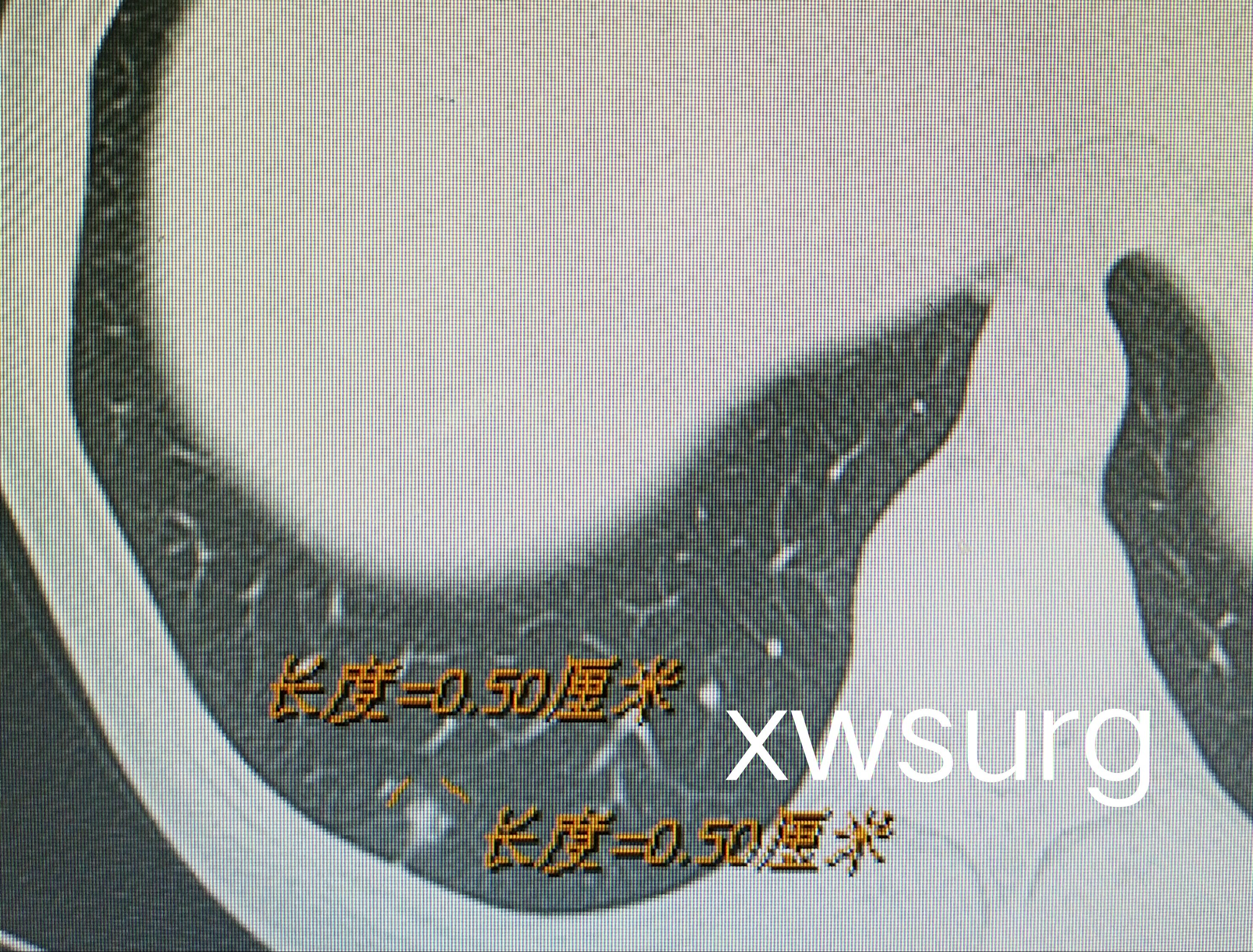 暂无